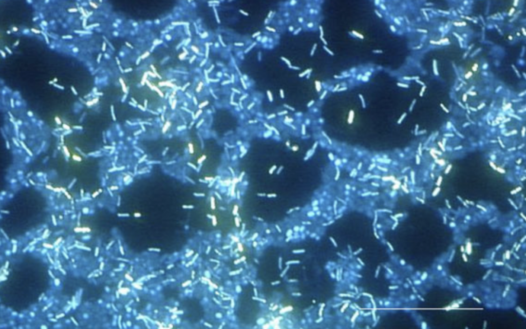 Biofilm – NTM Bacteria’s Secret Weapon